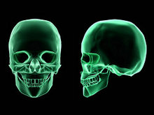 人体X光照片高清图片