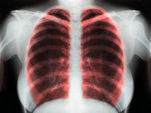 人体X光照片高清图片