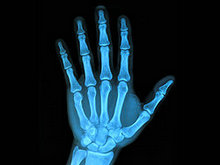 人体X光照片12高清图片