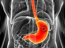胃部身体器官X光片高清图片