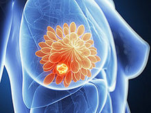 乳房器官X光片高清图片