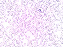 显微镜下中性粒细胞高清图片