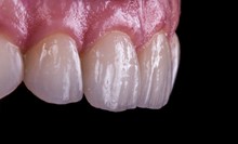 口腔牙齿结构高清图片